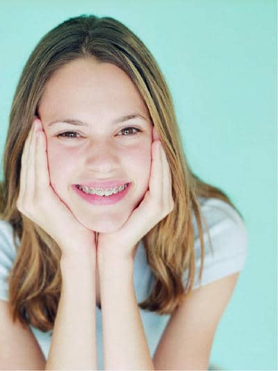 types of braces